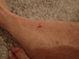 <h5>Boo Boo #2</h5>